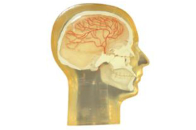 Angiographic Head Phantom血管造影头部模型